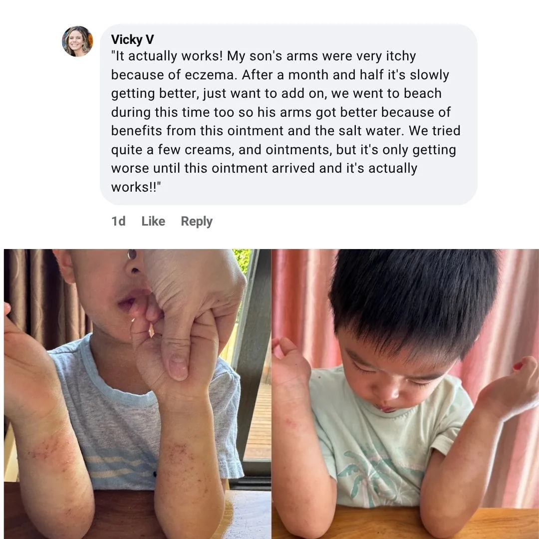 Healed By The Sea - Eczema Formula